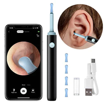 SENVES™  - PROFESSIONAL EAR WAX REMOVAL TOOL